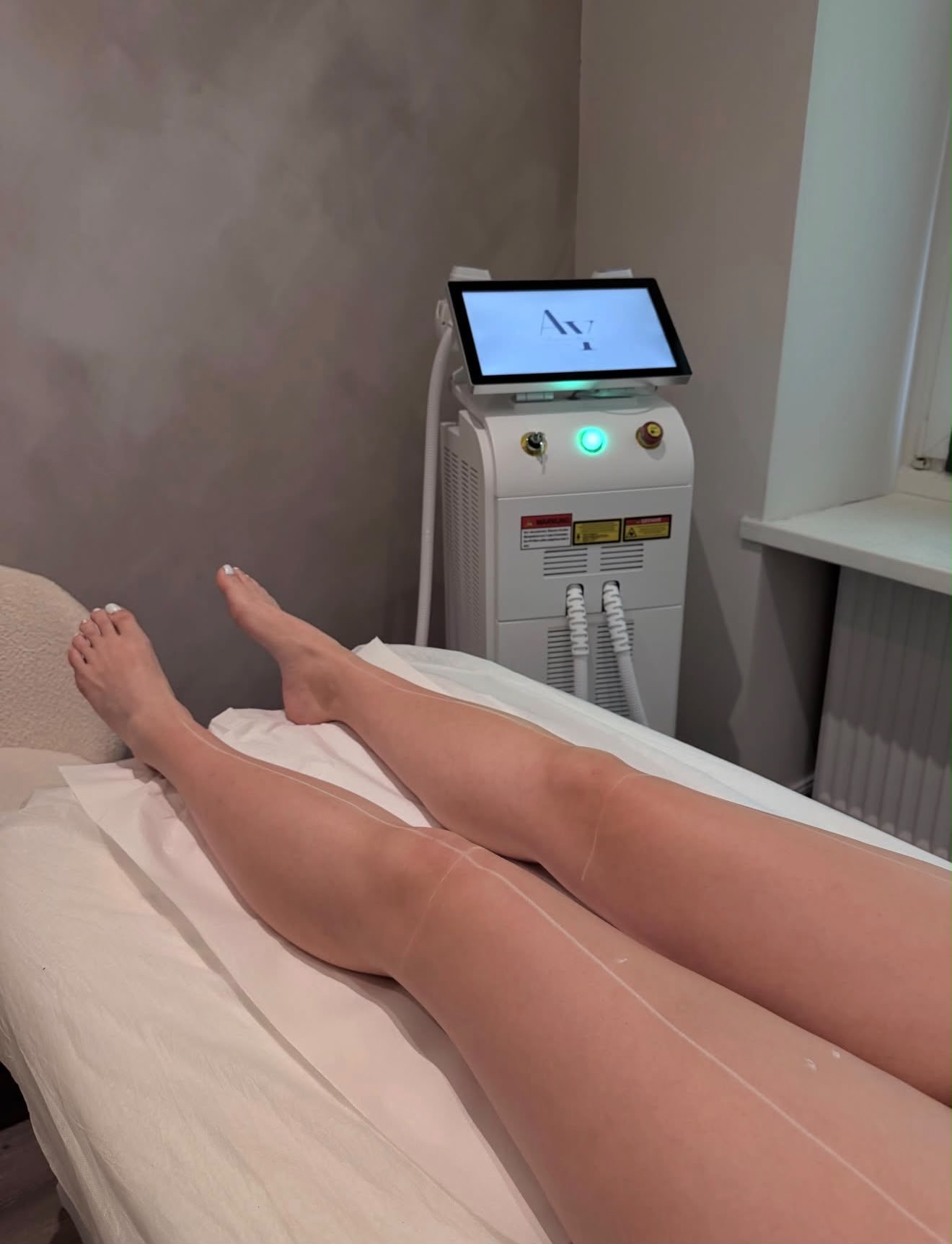 Diodenlaser Behandlung im Studio